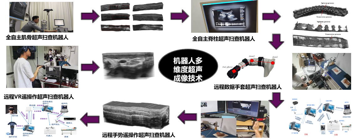 机器人多维度超声成像技术
