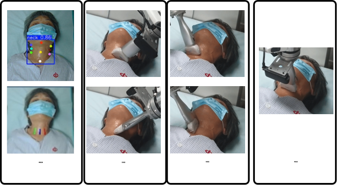 临床场景中的甲状腺机器人超声验证